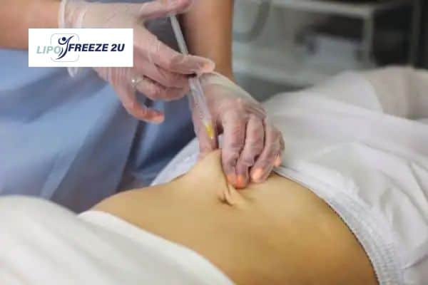 Fat Dissolving Injections Coombe Bissett & Weight loss medication