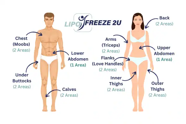 Areas you can have fat freezing treatment Coombe Bissett