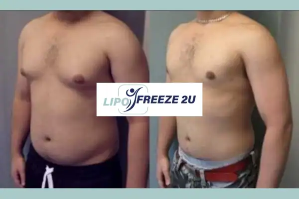 How Long Does It Take to See Results Coombe Bissett?