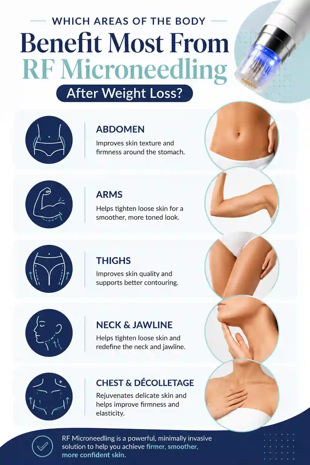 Which Areas of the Body Benefit Most From RF Microneedling After Weight Loss Coombe Bissett
